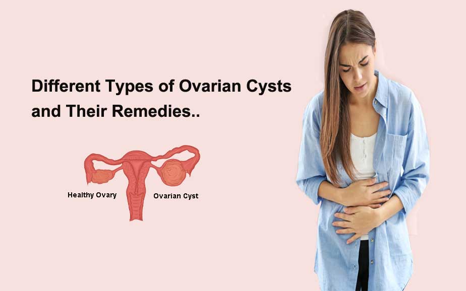 Different types of ovarian cysts