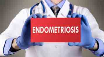 Does Endometriosis Cause UTIs