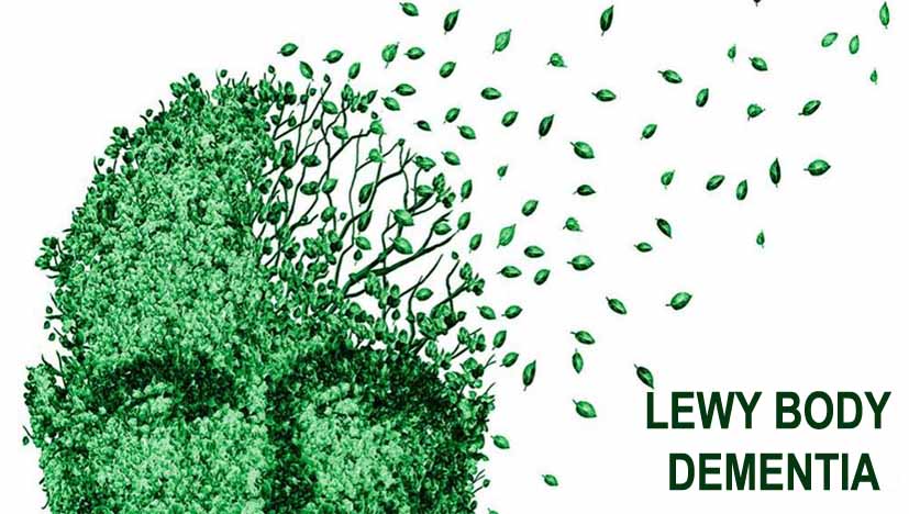 What Are The 7 Stages Of Lewy Body Dementia